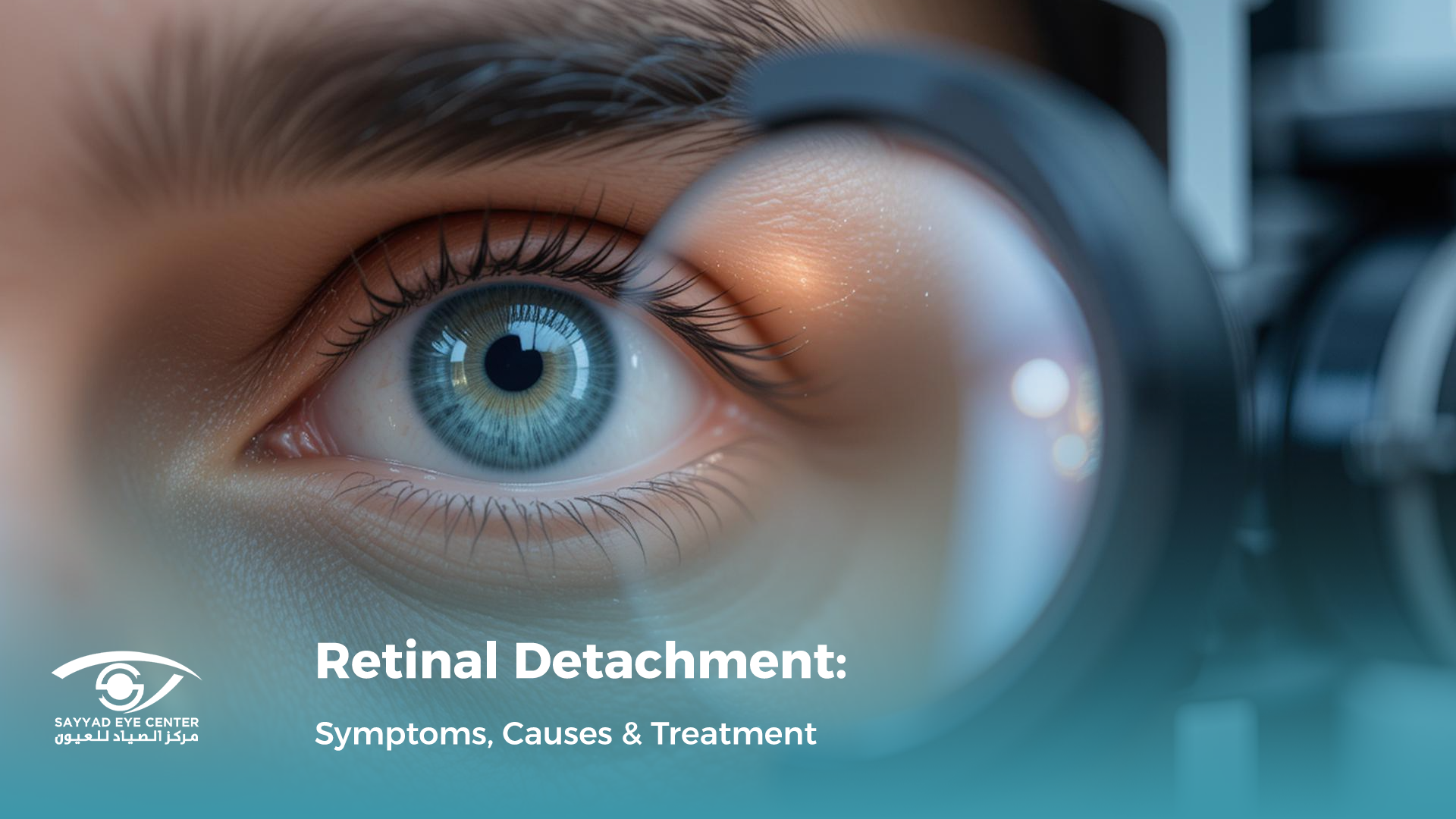 Retinal Detachment: Symptoms, Causes & Treatment | Sayyad Eye Center