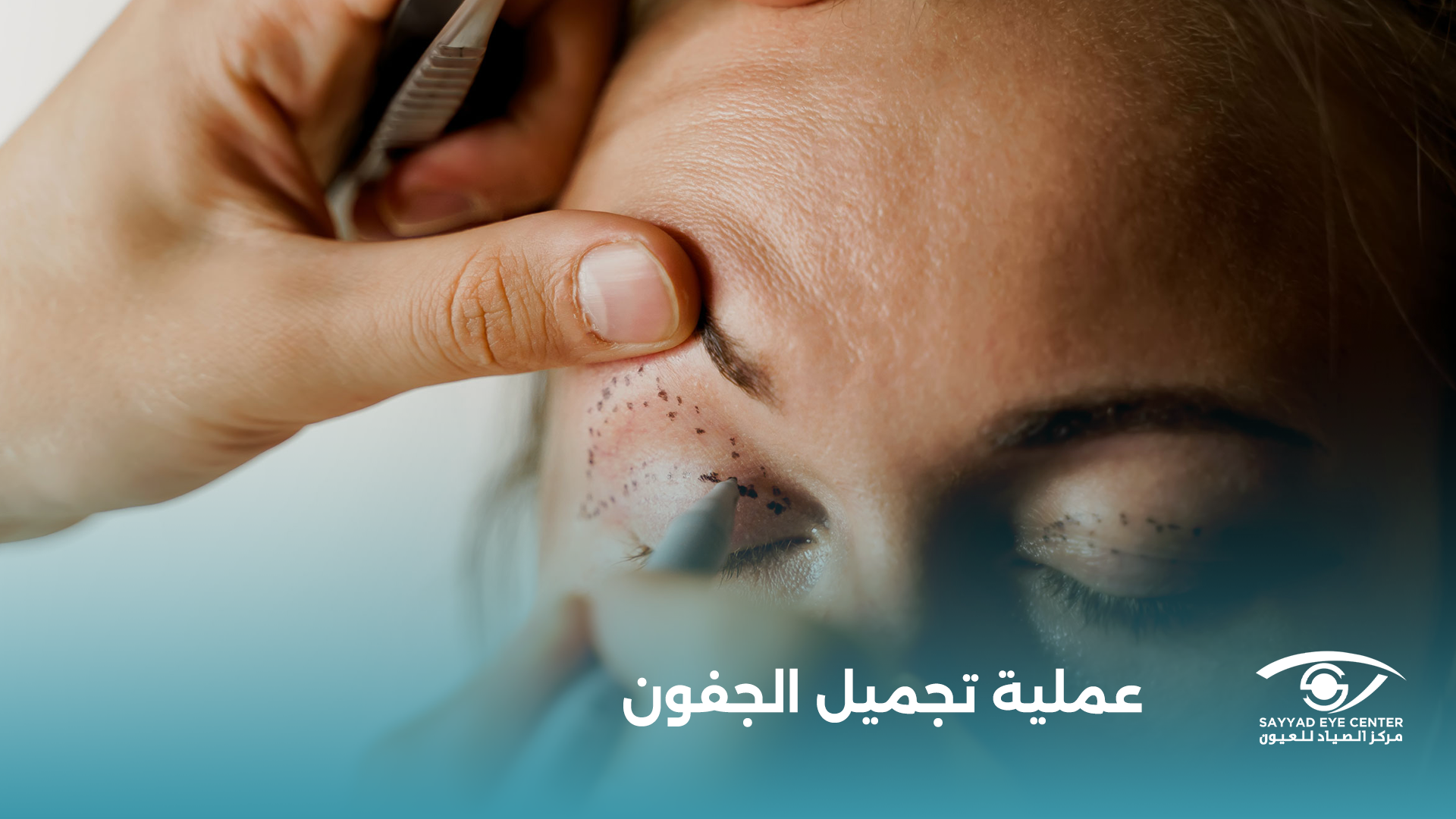 عملية تجميل الجفون: الأنواع والتحضير والتعافي والمخاطر