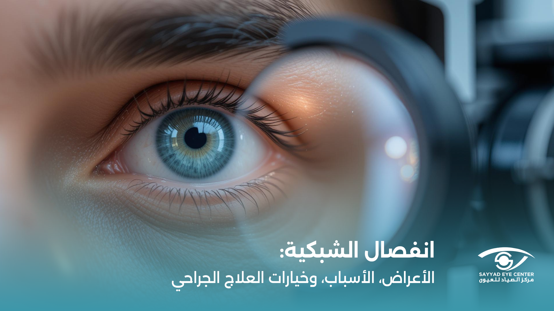 انفصال الشبكية: الأعراض والأسباب وطرق العلاج والتعافي